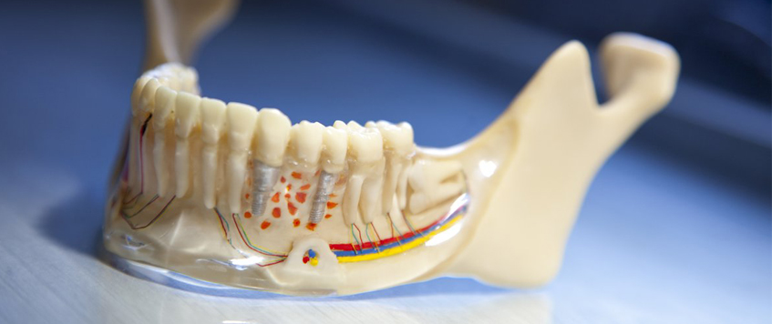 Endodonti Kanal Tedavisi Gebze